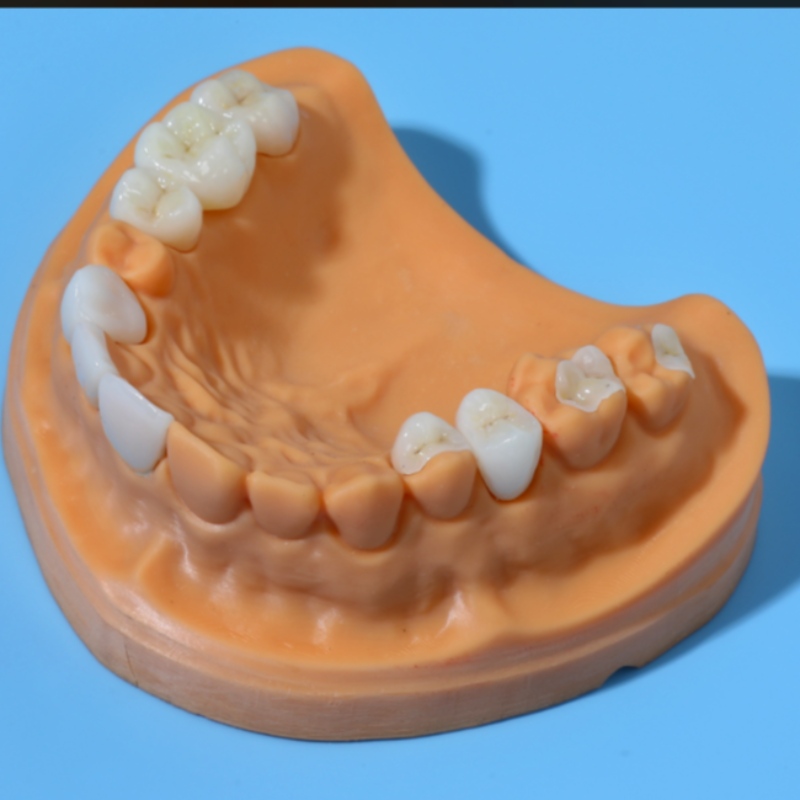 New Article Alert: Full vs. Partial vs. Immediate Dentures – What’s the Difference?